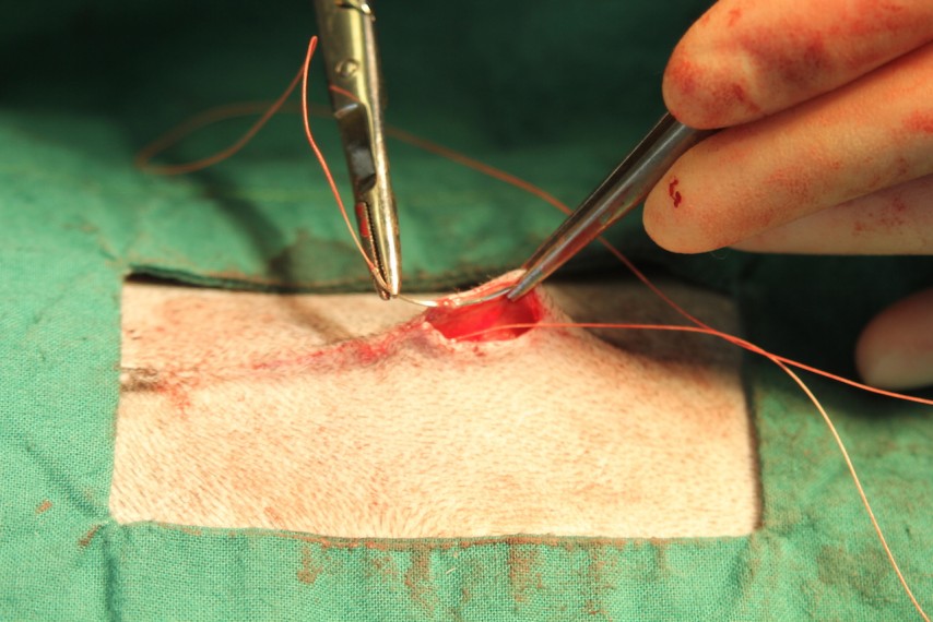 placing suture
