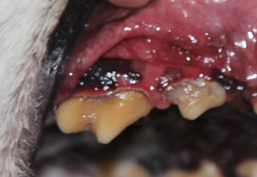 periodontal disease