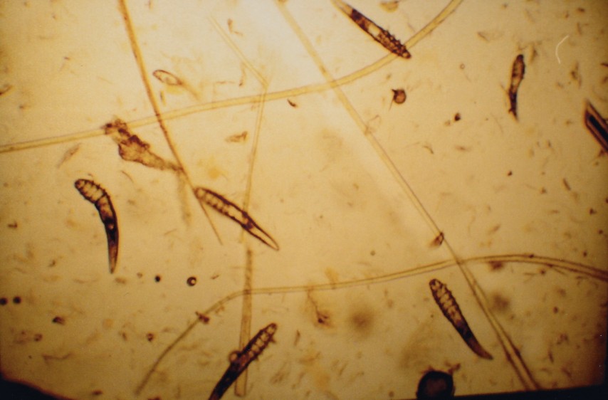 demodicosis