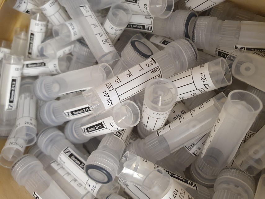 Serum tube