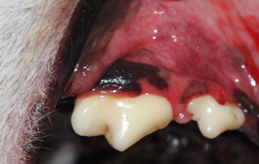 Scaling teeth